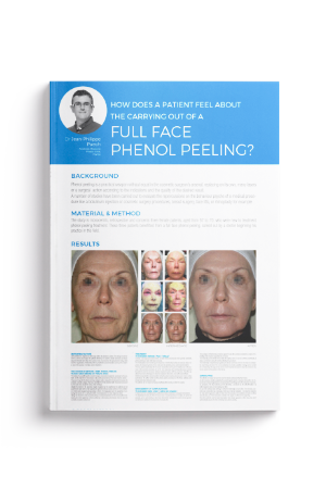 Full Face Phenol Peeling?