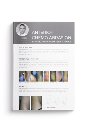 Anterior Chemo Abrasion