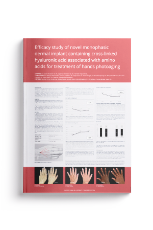 Efficacy study of novel monophasic dermal implant containing cross-linked hyaluronic acid associated with amino acids for treatment of hands photoaging